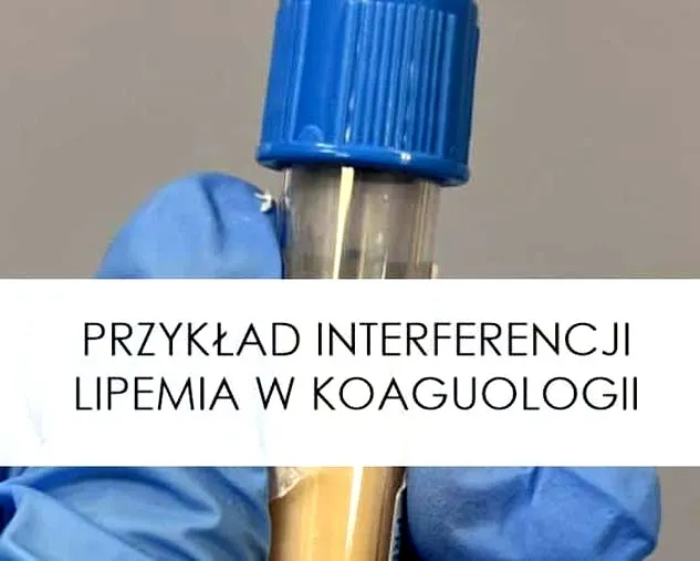 Czym jest lipemia u psa i jak wpływa na jego zdrowie?