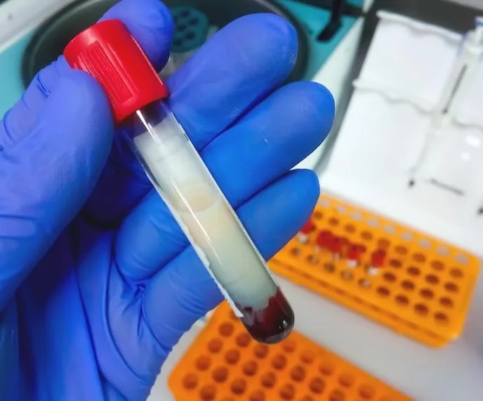 Lipemia u psa