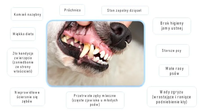 Objawy kamienia nazębnego