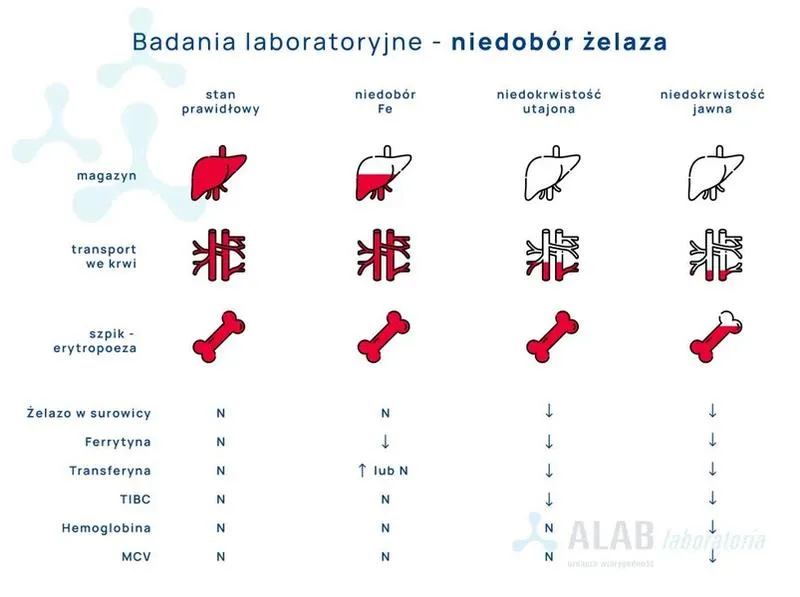 Objawy niedoboru żelaza