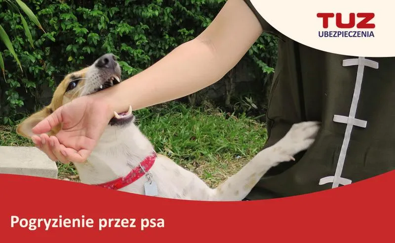 Wyliczenie zadośćuczynienia za pogryzienie